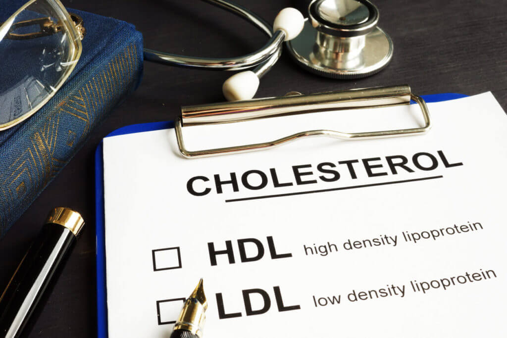 Cholesterol Numbers - Robert E Lending MD - Tucson AZ