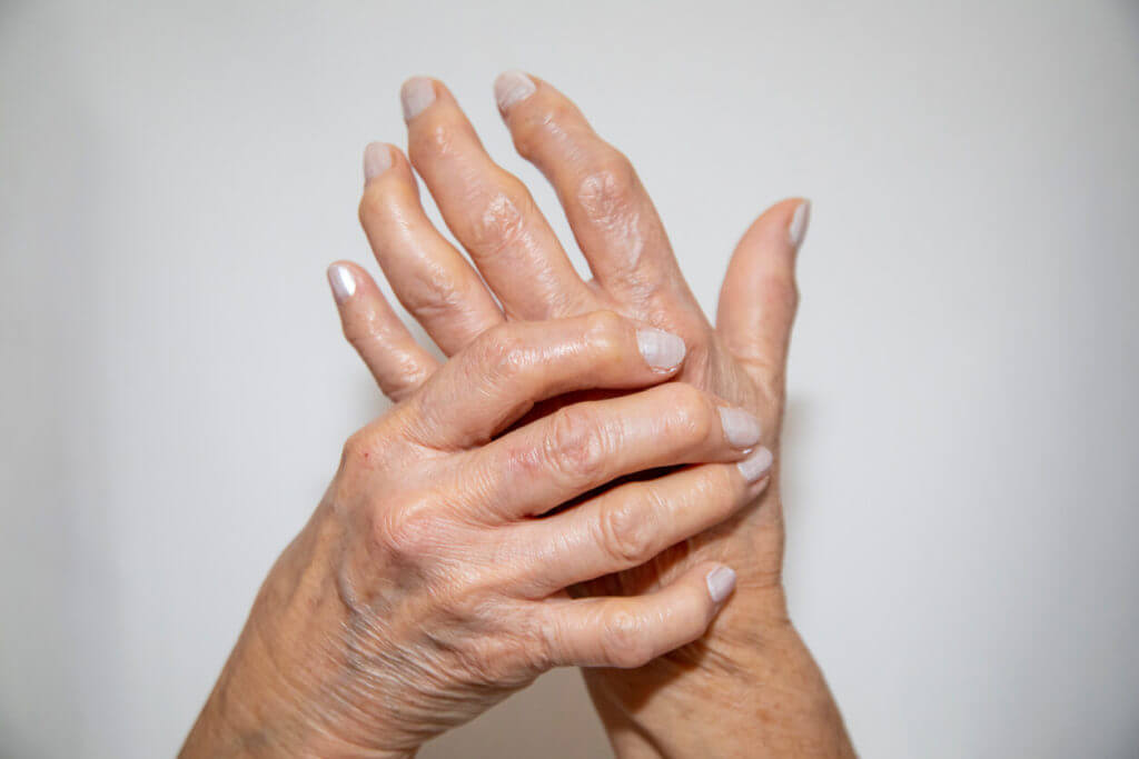 Image of rheumatoid arthritis, depicting a woman experiencing severe pain in her wrist.