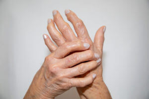 Image of rheumatoid arthritis, depicting a woman experiencing severe pain in her wrist.